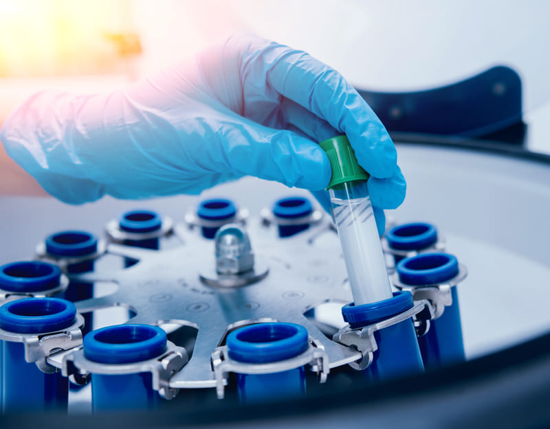 centrifuga de laboratorio o que e cuidados e riscos